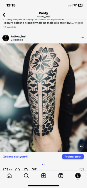 Mikropigmentacja skóry głowy 1image0