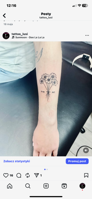 Mikropigmentacja skóry głowy image8